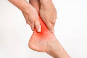 an image describing a plantar fasciitis condition