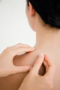 female patient receiving dry needling treatments