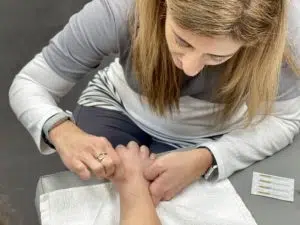 chiropractor treating carpal tunnel syndrome on a patient's hand through dry needling