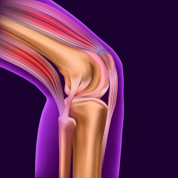 Knee pain. Trauma to the leg, patella, knee joint. Medical neon vector illustration isolated on a dark background.