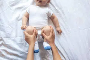 Baby with Torticollis getting treated