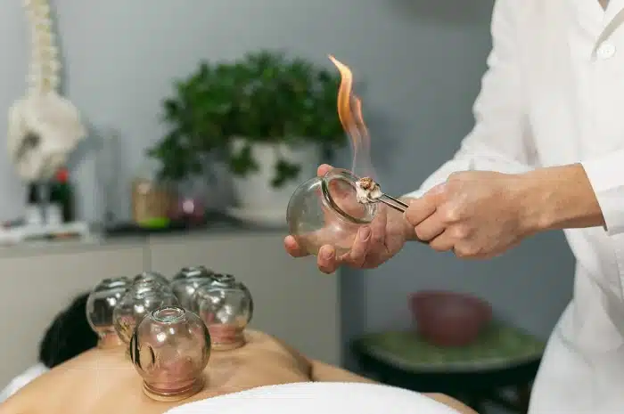 cupping therapy session with a professional practitioner